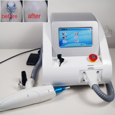 Laser-Tätowierungs-Abbau-Maschine Q der Augenbrauen-500W schaltete Kohlenstoff-Schale Nd YAG