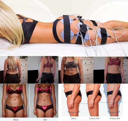 Salon elektrische EMS-Muskel-Anregungs-Maschinen-Eignung für Cellulite