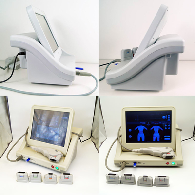 Facelift HIFU, der Antifalte der Maschinen-1.5mm 3.0mm SMAS abnimmt